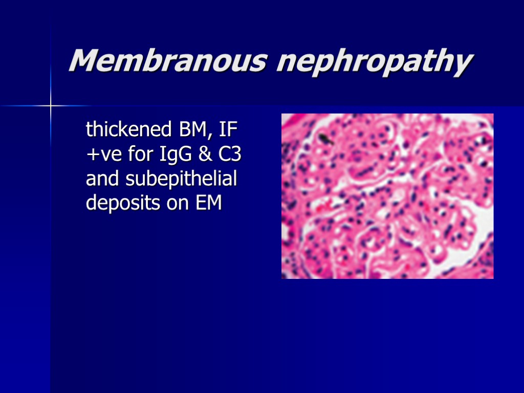 Membranous nephropathy thickened BM, IF +ve for IgG & C3 and subepithelial deposits on